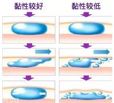 伊婉玻尿酸有几个型号 伊婉c型和v型的区别 